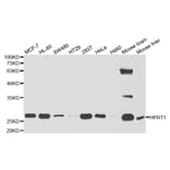 Anti-HPRT1 Antibody from Bioworld Technology (BS7630) - Antibodies.com