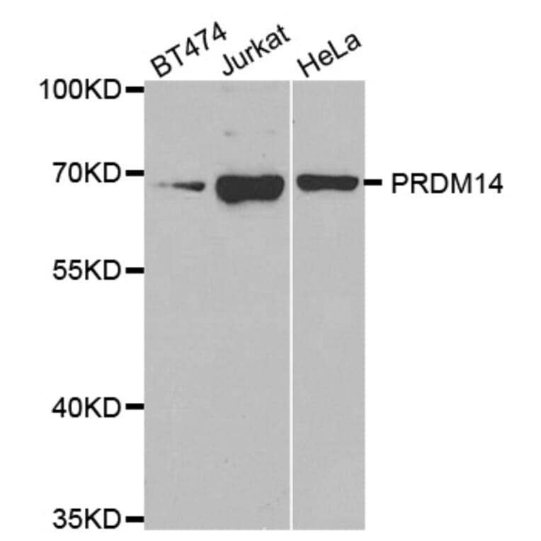 Anti-PRDM14 Antibody from Bioworld Technology (BS7634) - Antibodies.com