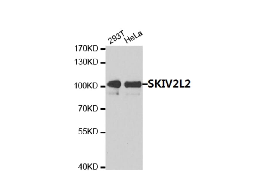 Anti-SKIV2L2  Antibody from Bioworld Technology (BS7637) - Antibodies.com