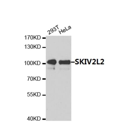 Anti-SKIV2L2  Antibody from Bioworld Technology (BS7637) - Antibodies.com