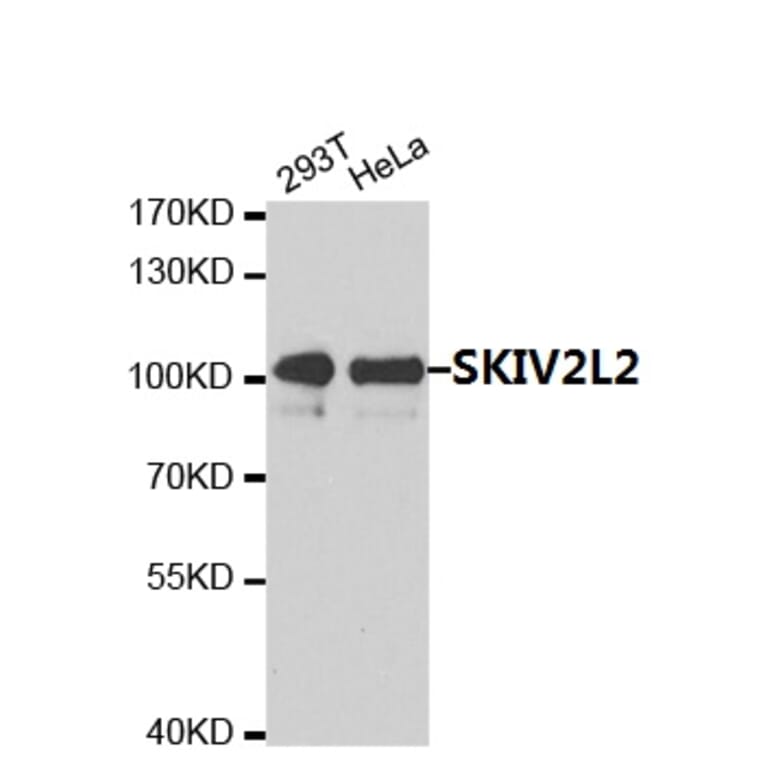 Anti-SKIV2L2  Antibody from Bioworld Technology (BS7637) - Antibodies.com
