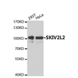 Anti-SKIV2L2  Antibody from Bioworld Technology (BS7637) - Antibodies.com