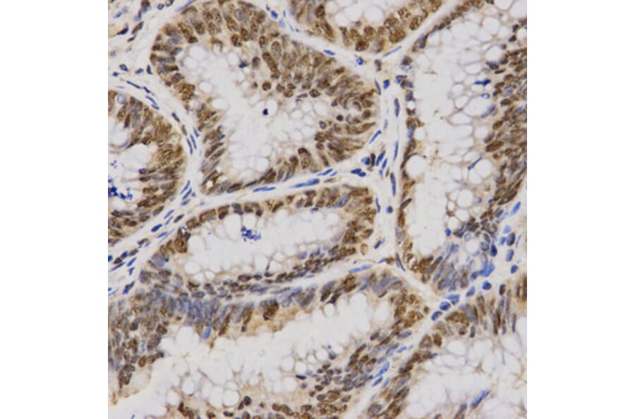 Anti-SKIV2L2  Antibody from Bioworld Technology (BS7637) - Antibodies.com