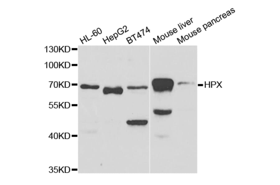 Anti-HPX Antibody from Bioworld Technology (BS7640) - Antibodies.com