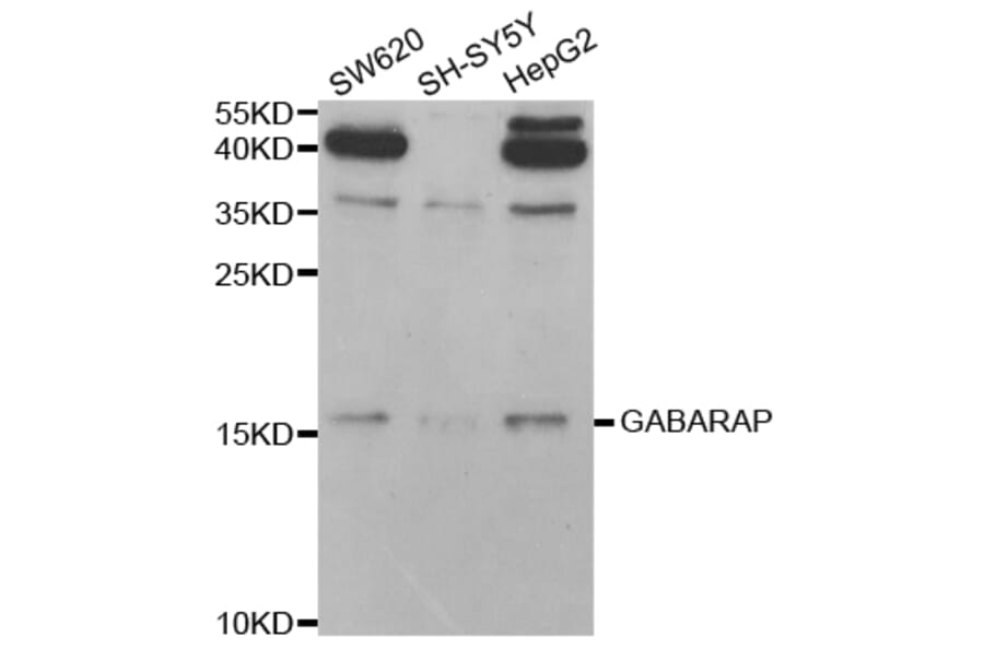 Anti-GABARAP Antibody from Bioworld Technology (BS7642) - Antibodies.com
