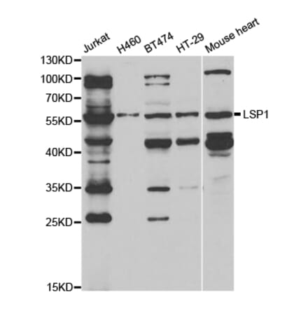 Anti-LSP1 Antibody from Bioworld Technology (BS7643) - Antibodies.com