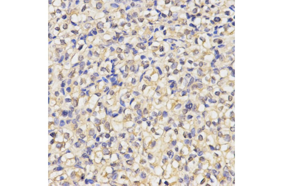 Anti-MAP1LC3A Antibody from Bioworld Technology (BS7644) - Antibodies.com