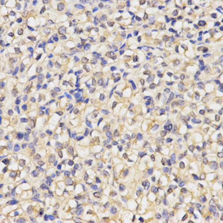 Anti-MAP1LC3A Antibody from Bioworld Technology (BS7644) - Antibodies.com