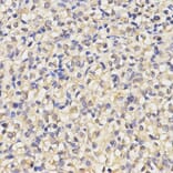 Anti-MAP1LC3A Antibody from Bioworld Technology (BS7644) - Antibodies.com