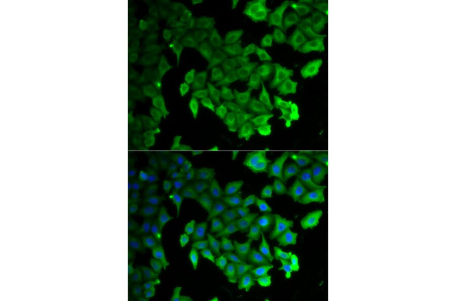 Anti-MAP1LC3A Antibody from Bioworld Technology (BS7644) - Antibodies.com