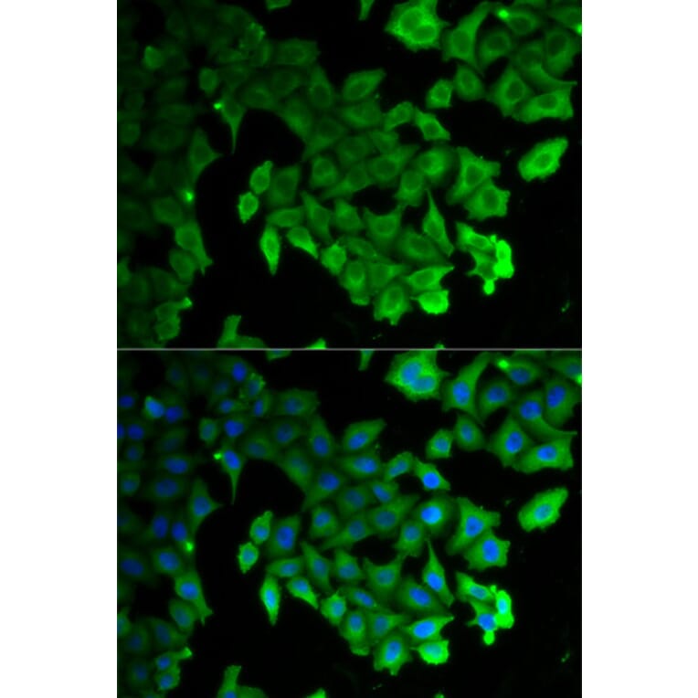 Anti-MAP1LC3A Antibody from Bioworld Technology (BS7644) - Antibodies.com