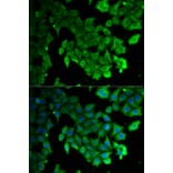 Anti-MAP1LC3A Antibody from Bioworld Technology (BS7644) - Antibodies.com