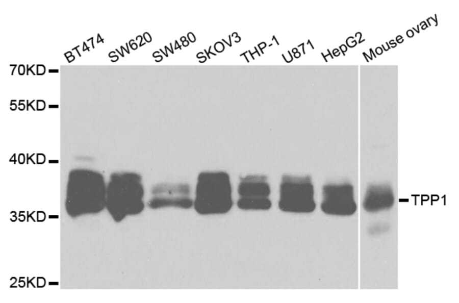Anti-TPP1 Antibody from Bioworld Technology (BS7647) - Antibodies.com