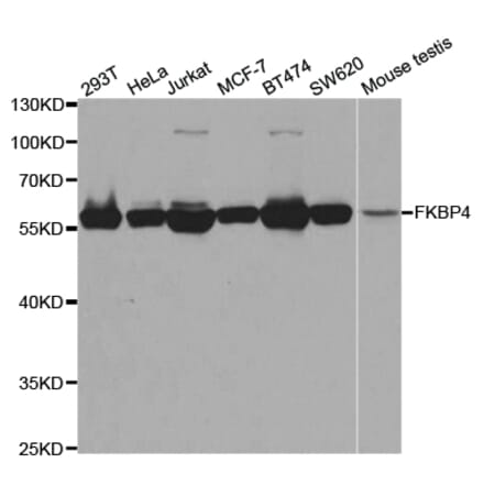 Anti-FKBP4 Antibody from Bioworld Technology (BS7652) - Antibodies.com