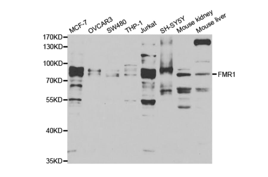 Anti-FMR1 Antibody from Bioworld Technology (BS7653) - Antibodies.com