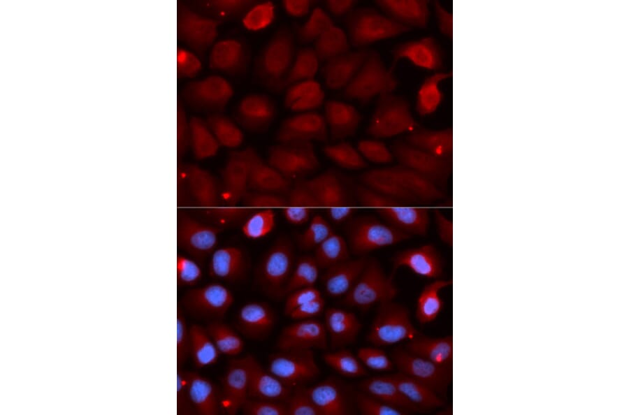 Anti-FMR1 Antibody from Bioworld Technology (BS7653) - Antibodies.com