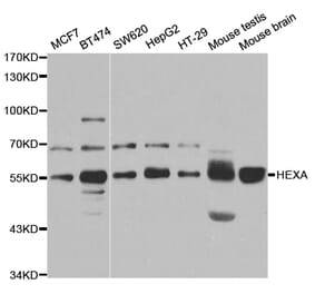 Anti-HEXA Antibody from Bioworld Technology (BS7654) - Antibodies.com
