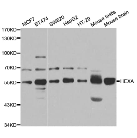 Anti-HEXA Antibody from Bioworld Technology (BS7654) - Antibodies.com