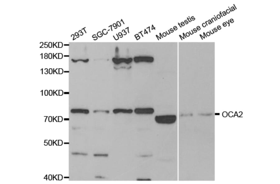 Anti-OCA2 Antibody from Bioworld Technology (BS7656) - Antibodies.com