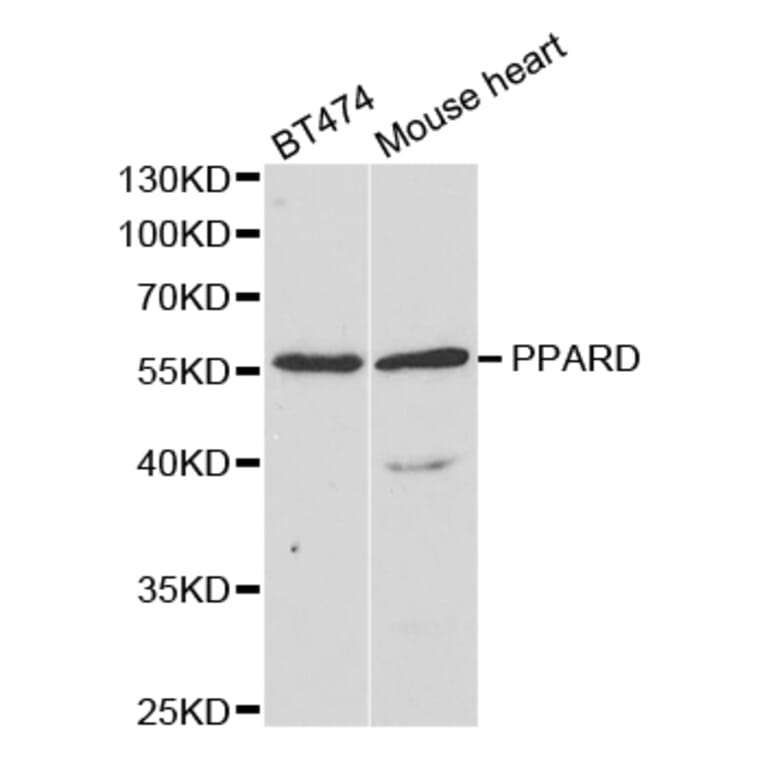 Anti-PPARD Antibody from Bioworld Technology (BS7657) - Antibodies.com
