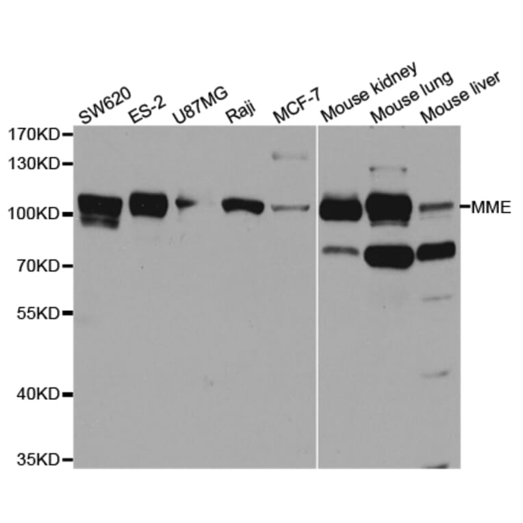 Anti-MME Antibody from Bioworld Technology (BS7658) - Antibodies.com