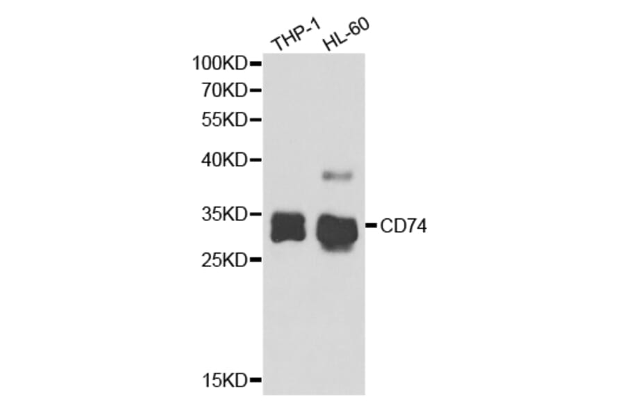 Anti-CD74 Antibody from Bioworld Technology (BS7660) - Antibodies.com