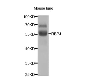 Anti-RBPJ Antibody from Bioworld Technology (BS7661) - Antibodies.com