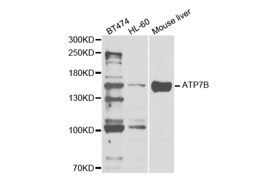 Anti-ATP7B Antibody from Bioworld Technology (BS7662) - Antibodies.com