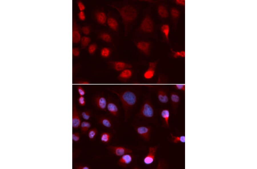 Anti-ATP7B Antibody from Bioworld Technology (BS7662) - Antibodies.com