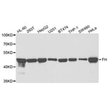 Anti-FH Antibody from Bioworld Technology (BS7665) - Antibodies.com