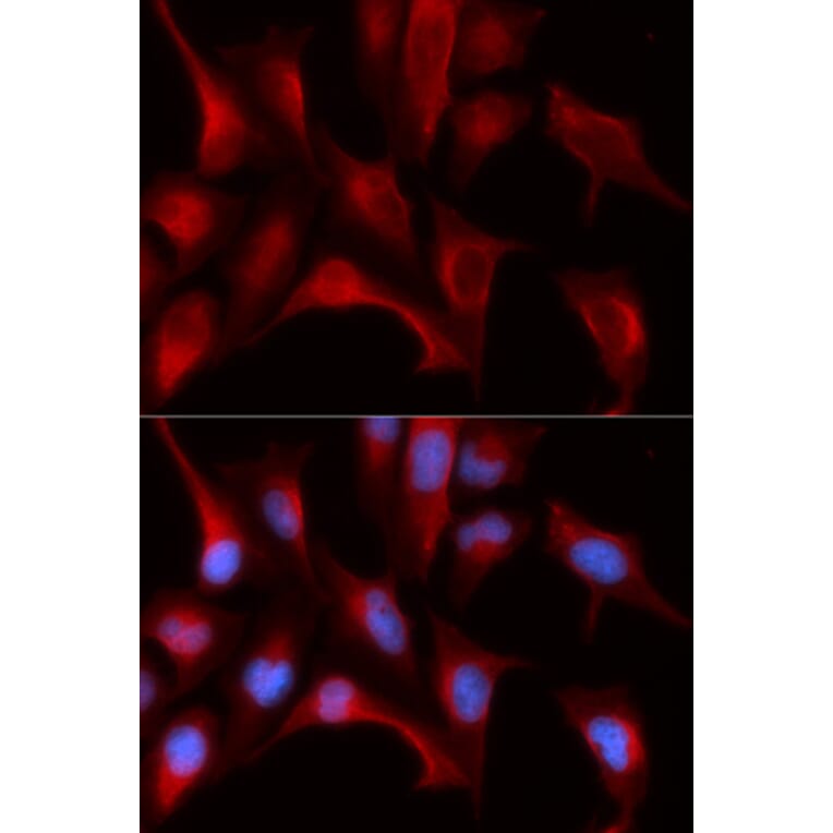 Anti-PSMB4 Antibody from Bioworld Technology (BS7667) - Antibodies.com