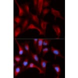 Anti-PSMB4 Antibody from Bioworld Technology (BS7667) - Antibodies.com