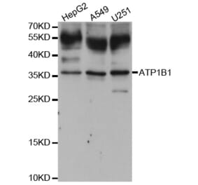 Anti-ATP1B1 Antibody from Bioworld Technology (BS7669) - Antibodies.com