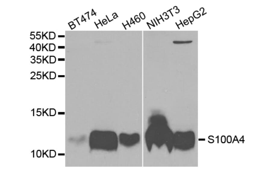 Anti-S100A4 Antibody from Bioworld Technology (BS7671) - Antibodies.com
