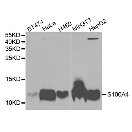 Anti-S100A4 Antibody from Bioworld Technology (BS7671) - Antibodies.com