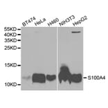 Anti-S100A4 Antibody from Bioworld Technology (BS7671) - Antibodies.com