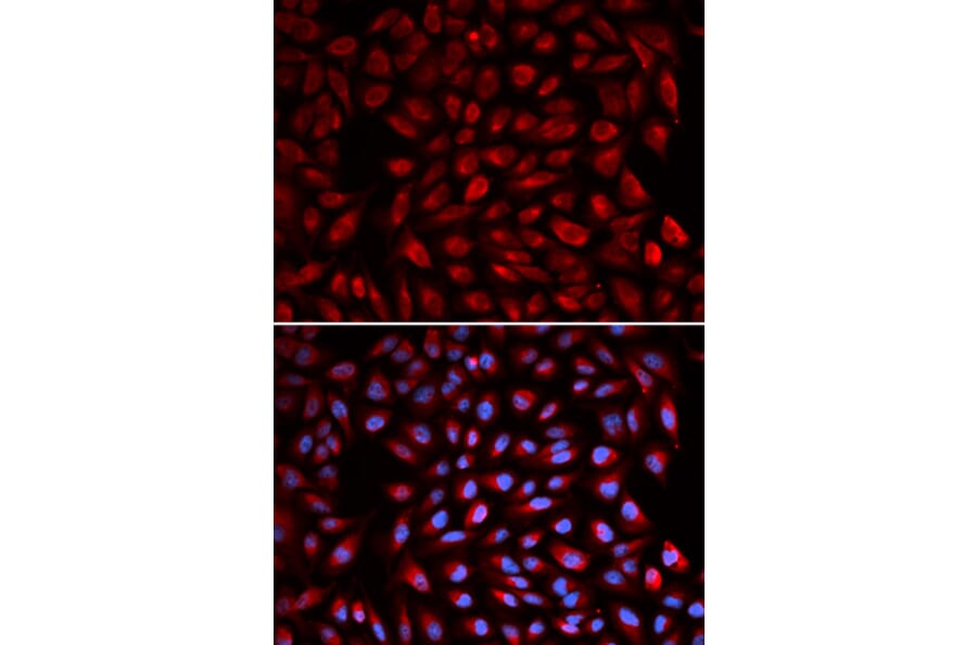 Anti-RARA Antibody from Bioworld Technology (BS7672) - Antibodies.com