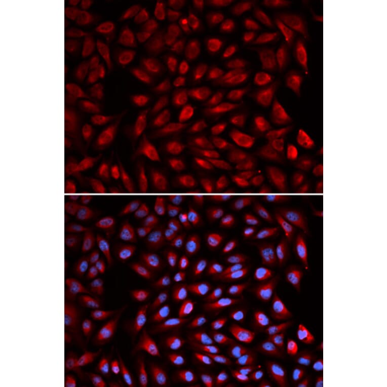 Anti-RARA Antibody from Bioworld Technology (BS7672) - Antibodies.com