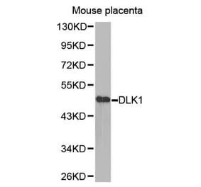 Anti-DLK1 Antibody from Bioworld Technology (BS7673) - Antibodies.com