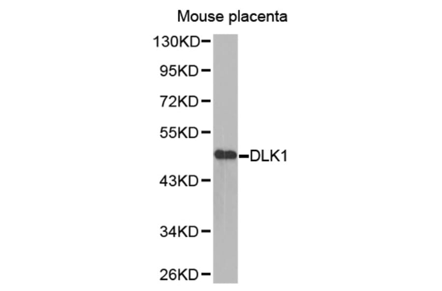 Anti-DLK1 Antibody from Bioworld Technology (BS7673) - Antibodies.com
