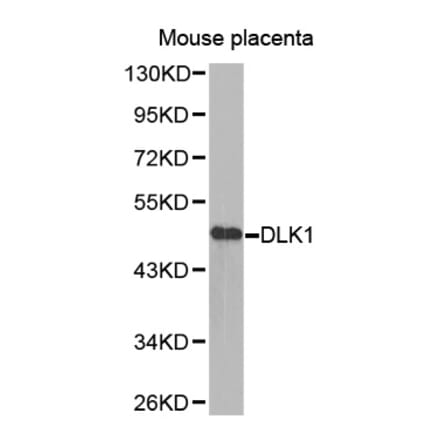 Anti-DLK1 Antibody from Bioworld Technology (BS7673) - Antibodies.com