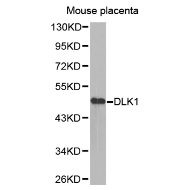 Anti-DLK1 Antibody from Bioworld Technology (BS7673) - Antibodies.com