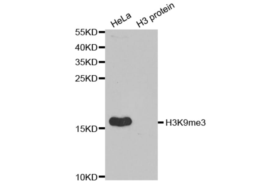 Anti-Histone H3 (Tri-Methyl K9) Antibody from Bioworld Technology (BS7675) - Antibodies.com