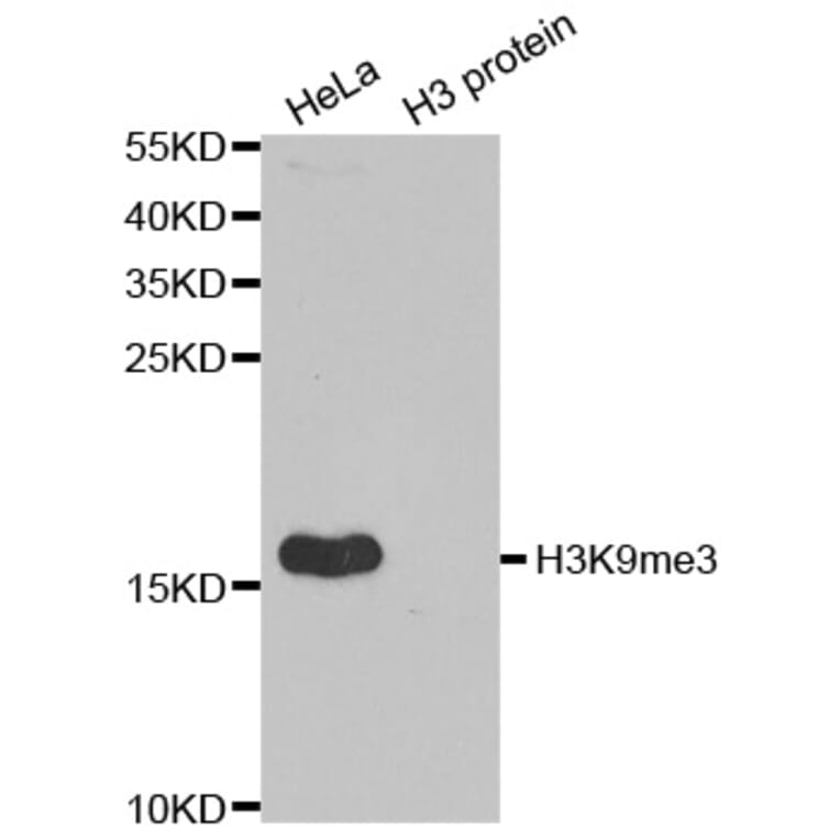 Anti-Histone H3 (Tri-Methyl K9) Antibody from Bioworld Technology (BS7675) - Antibodies.com