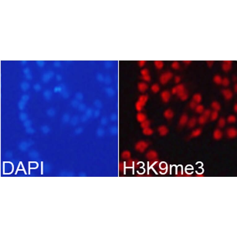 Anti-Histone H3 (Tri-Methyl K9) Antibody from Bioworld Technology (BS7675) - Antibodies.com