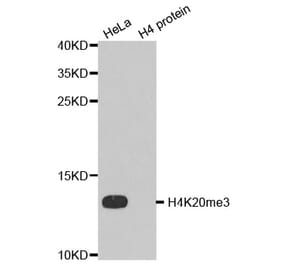Anti-Histone H4 (Tri-Methyl K20) Antibody from Bioworld Technology (BS7676) - Antibodies.com