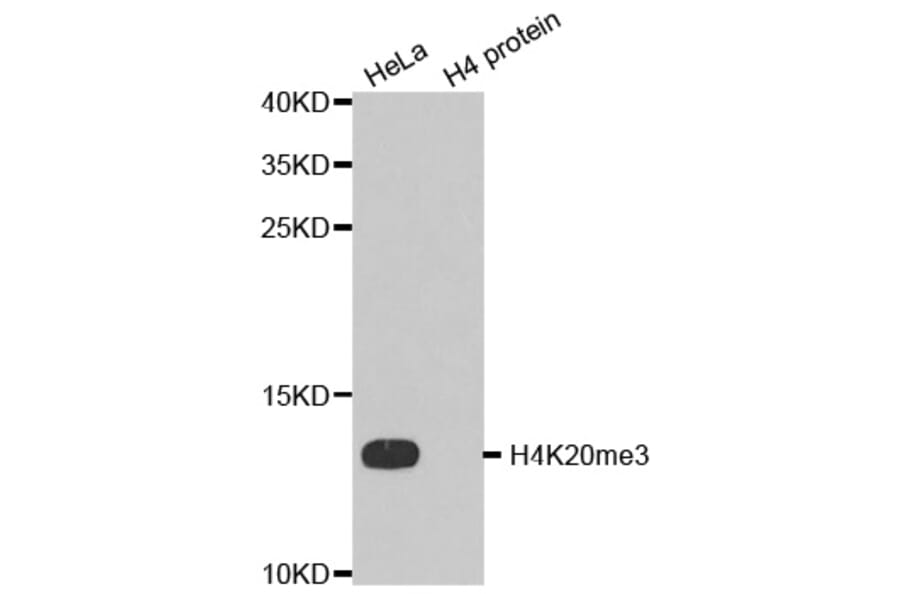 Anti-Histone H4 (Tri-Methyl K20) Antibody from Bioworld Technology (BS7676) - Antibodies.com