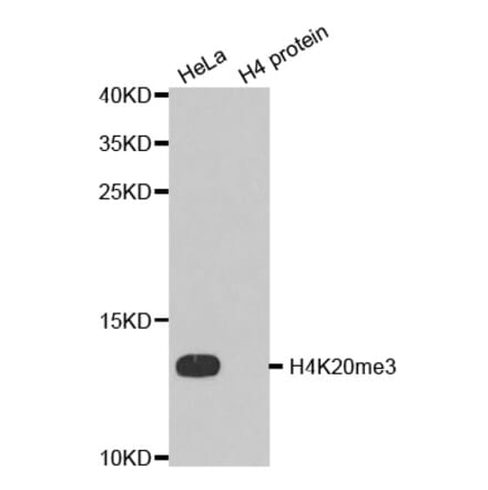 Anti-Histone H4 (Tri-Methyl K20) Antibody from Bioworld Technology (BS7676) - Antibodies.com