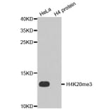 Anti-Histone H4 (Tri-Methyl K20) Antibody from Bioworld Technology (BS7676) - Antibodies.com