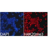 Anti-Histone H4 (Tri-Methyl K20) Antibody from Bioworld Technology (BS7676) - Antibodies.com